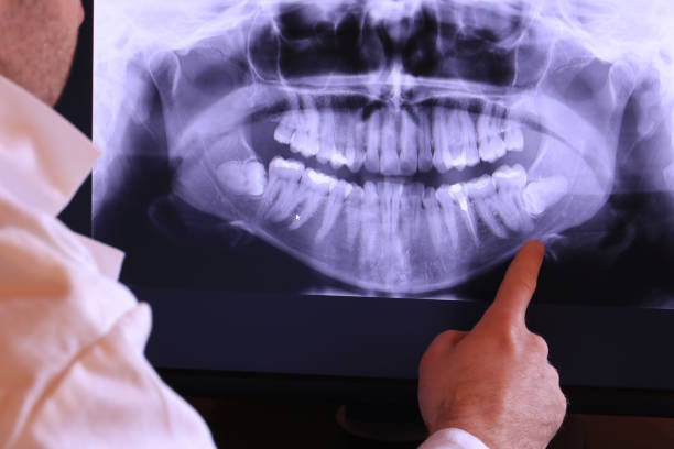 Best Urgent Care for Lost Fillings or Crowns in North Newton, KS