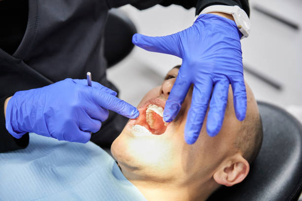 Best Emergency Tooth Extraction in North Newton, KS